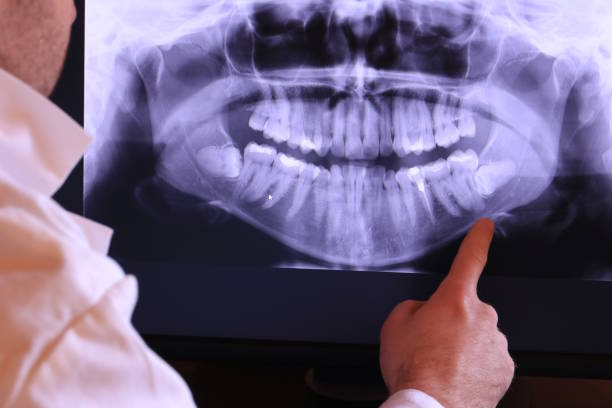 Best Emergency Dental Care for Broken or Chipped Teeth in Guntown, MS